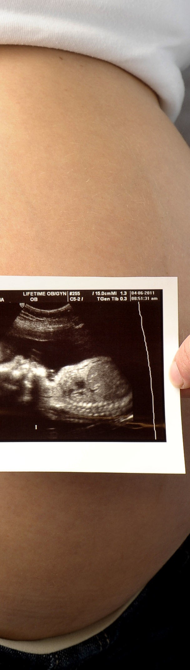 Pregnancy Photography